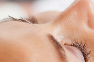 needling of the face, facial acupuncture, facial rejuvenation, anti-aging, acupuncture