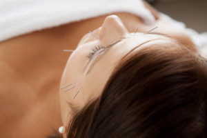 cosmetic acupuncture, Mei Zen cosmetic acupuncture, facial rejuvenation, facial needling