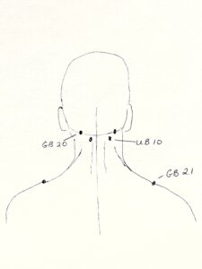 acupuncture points UB 10, GB 20., GB 21 on the back of a person's head